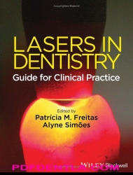 Lasers in Dentistry - Guide for Clinical Practice, 1st Edition (pdf)